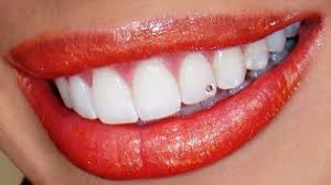 Zubni nakit